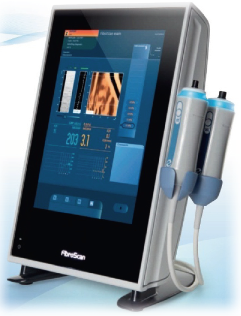 Fibroscan